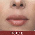 Бальзам для губ Perfect Pout  - Skin Doctors - косметика